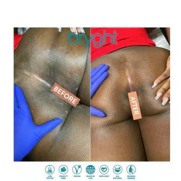 Rectal Bleaching: A Real Guide to Safer, Smarter Skin Brightening