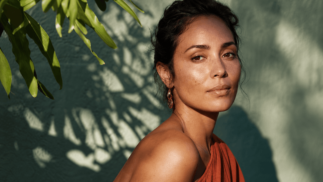 Woman with natural facial pigmentation standing in dappled sunlight